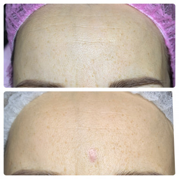 Марія Назарчук, Рівне Фото - 38