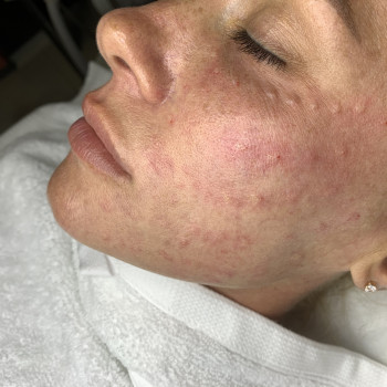 Марія Назарчук, Рівне Фото - 46