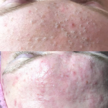 Юлия Турубарова, Мелітополь Фото - 8