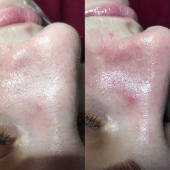 Юлия Турубарова, Мелітополь Фото - 9