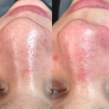 Юлия Турубарова, Мелітополь Фото - 10