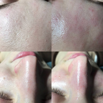 Юлия Турубарова, Мелітополь Фото - 11