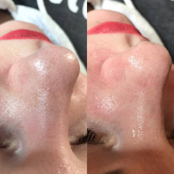 Юлия Турубарова, Мелітополь Фото - 4