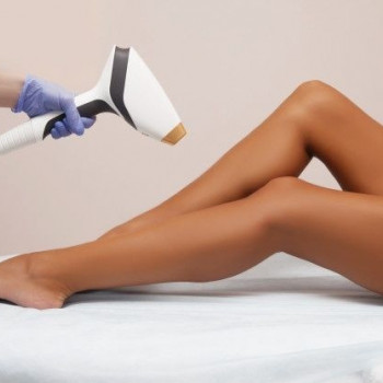 Лазерная эпиляция
                    Косметолог-ін'єкціоніст Лилия Київ