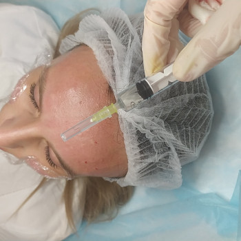 Мезотерапія
                    Врач-косметолог Тетяна Луцк