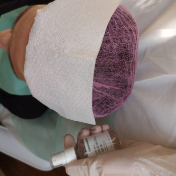 Пілінг
                    Лікар-косметолог Тетяна Луцьк