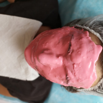 Карбоксітерапія
                    Лікар-косметолог Тетяна Луцьк