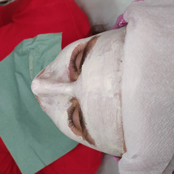 Карбоксітерапія
                    Лікар-косметолог Тетяна Луцьк