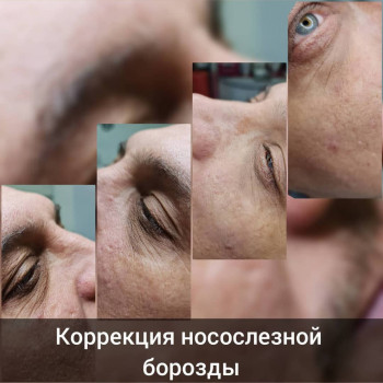 Наталья Биленко, Кам'янське Фото - 3