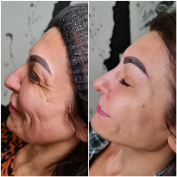 Скульптурирование лица