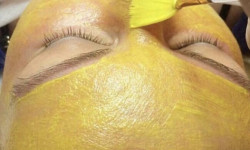 Ретиноловый пилинг Косметологічний центр O.L.Beauty Київ