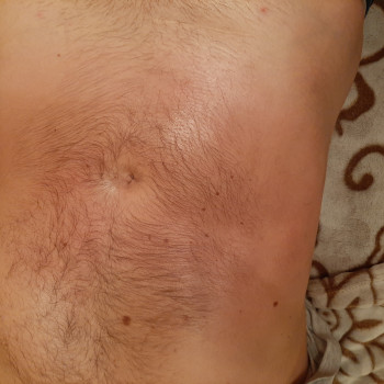 Разогретый животик после массажа