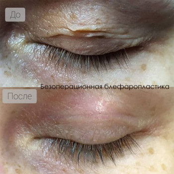 ALICE tattoo studio, Запорожье Фото - 49