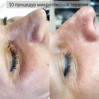 ALICE tattoo studio, Запорожье Фото - 51