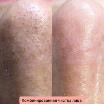 ALICE tattoo studio, Запорожье Фото - 52