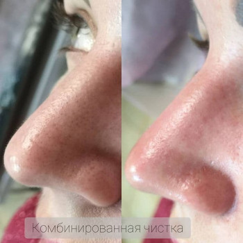 ALICE tattoo studio, Запорожье Фото - 53