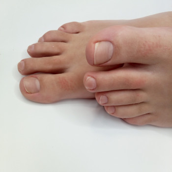 Медичний педикюр
                    Подолог Тетяна Каменец-Подольский