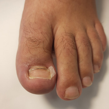 Медичний педикюр
                    Подолог Тетяна Каменец-Подольский