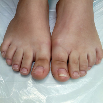 Медичний педикюр
                    Подолог Тетяна Каменец-Подольский