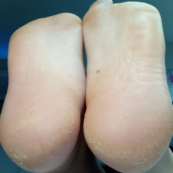 Медичний педикюр
                    Подолог Тетяна Каменец-Подольский