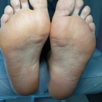 Медичний педикюр
                    Подолог Тетяна Каменец-Подольский