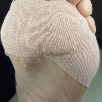 Медичний педикюр
                    Подолог Тетяна Каменец-Подольский