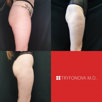 Марія ТРИФОНОВА, Київ Фото - 11