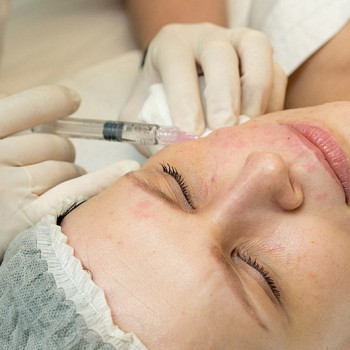 Мезотерапия
                    Косметолог-инъекционист Лилия Киев