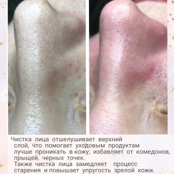 Tina Ricca, Кривой Рог Фото - 34