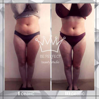 Антицеллюлитный массаж
                    Массажист Михаил Мариуполь