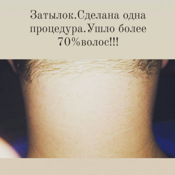 Любовь Рожнова, Запорожье Фото - 5