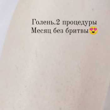 Любовь Рожнова, Запорожье Фото - 6