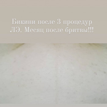 Любовь Рожнова, Запорожье Фото - 7