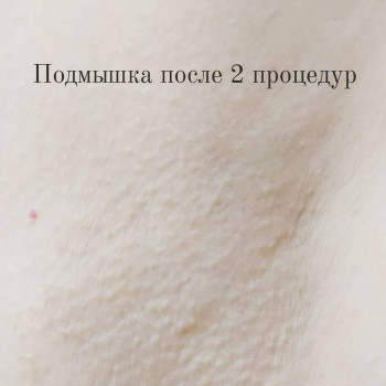 Любовь Рожнова, Запорожье Фото - 8