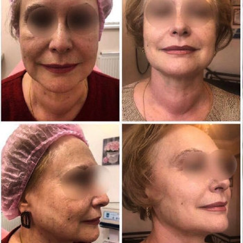 Ирина Приходченко, Сумы Фото - 7