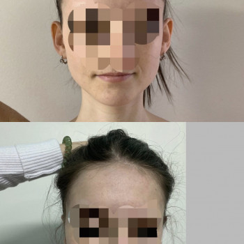 Святослав Ізбенко, Ивано-Франковск Фото - 8