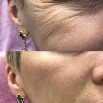 Beauty, Обухів Фото - 5