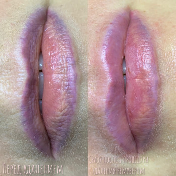 Алина Мельничук, Киев Фото - 25