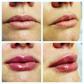 Фото из портфолио косметолога Оксана Вирская (Запорожье)