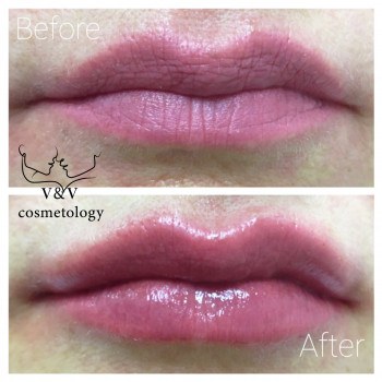 Фото из портфолио косметолога Оксана Вирская (Запорожье)