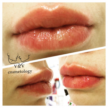 Фото из портфолио косметолога Оксана Вирская (Запорожье)