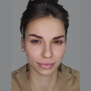 Артём Клосовский, Дніпро Фото - 7