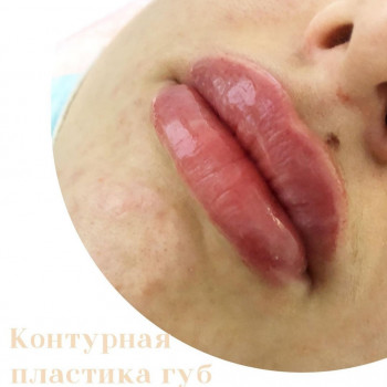 Tina Ricca, Кривой Рог Фото - 29