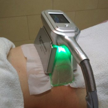 Фото процедури