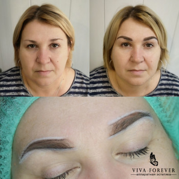 Кардинальное изменение формы