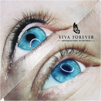 МЕЖРЕСНИЧКА