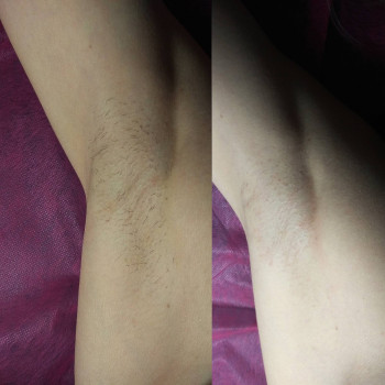 Анна Копылова, Запорожье Фото - 5