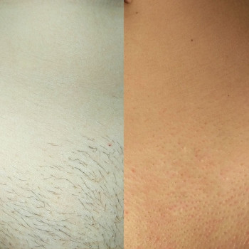 Анна Копылова, Запорожье Фото - 6