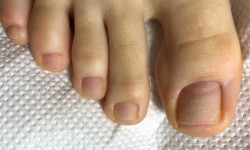 Педикюр Мастер маникюра Анна Херсон