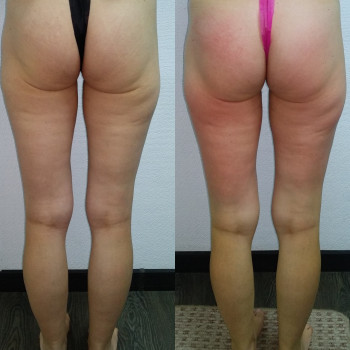 Ксенія Скалецька, Тернополь Фото - 5